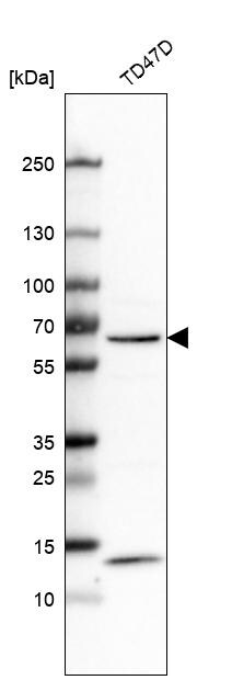 CRAT Antibody - BSA Free Western Blot: CRAT Antibody - BSA Free [NBP1-86616]