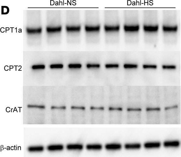 CRAT Antibody - BSA Free