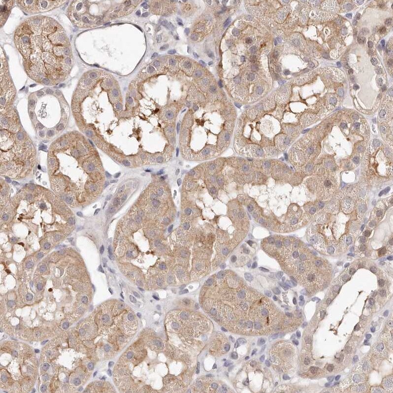 CASZ1 Antibody - BSA Free Immunohistochemistry-Paraffin: CASZ1 Antibody - BSA Free [NBP1-86617]