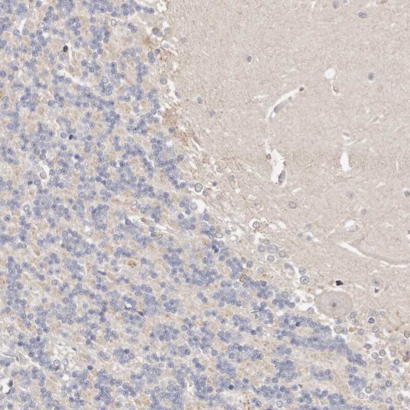 CASZ1 Antibody - BSA Free Immunohistochemistry-Paraffin: CASZ1 Antibody - BSA Free [NBP1-86617]
