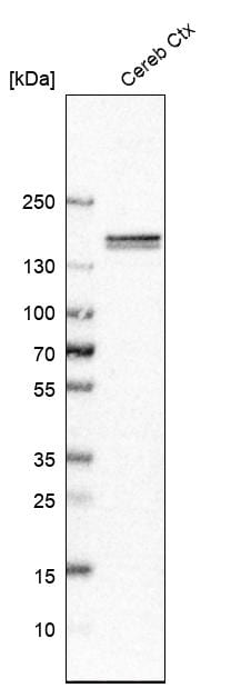 CNTNAP4 Antibody - BSA Free Western Blot: CNTNAP4 Antibody - BSA Free [NBP1-86619]