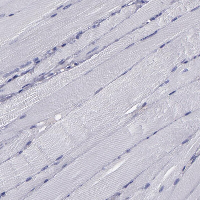 CARS Antibody - BSA Free Immunohistochemistry-Paraffin: CARS Antibody [NBP1-86623]