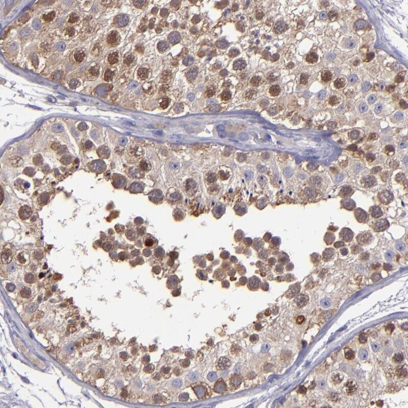 CARS Antibody - BSA Free Immunohistochemistry-Paraffin: CARS Antibody [NBP1-86623]