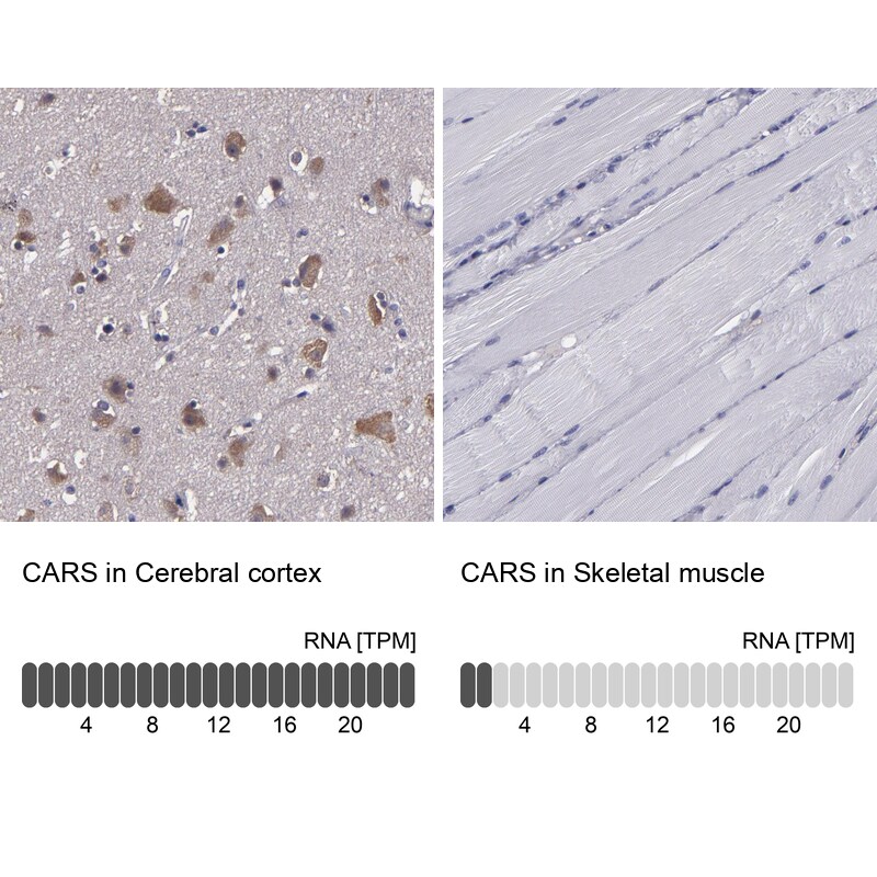 CARS Antibody - BSA Free Immunohistochemistry-Paraffin: CARS Antibody [NBP1-86623]
