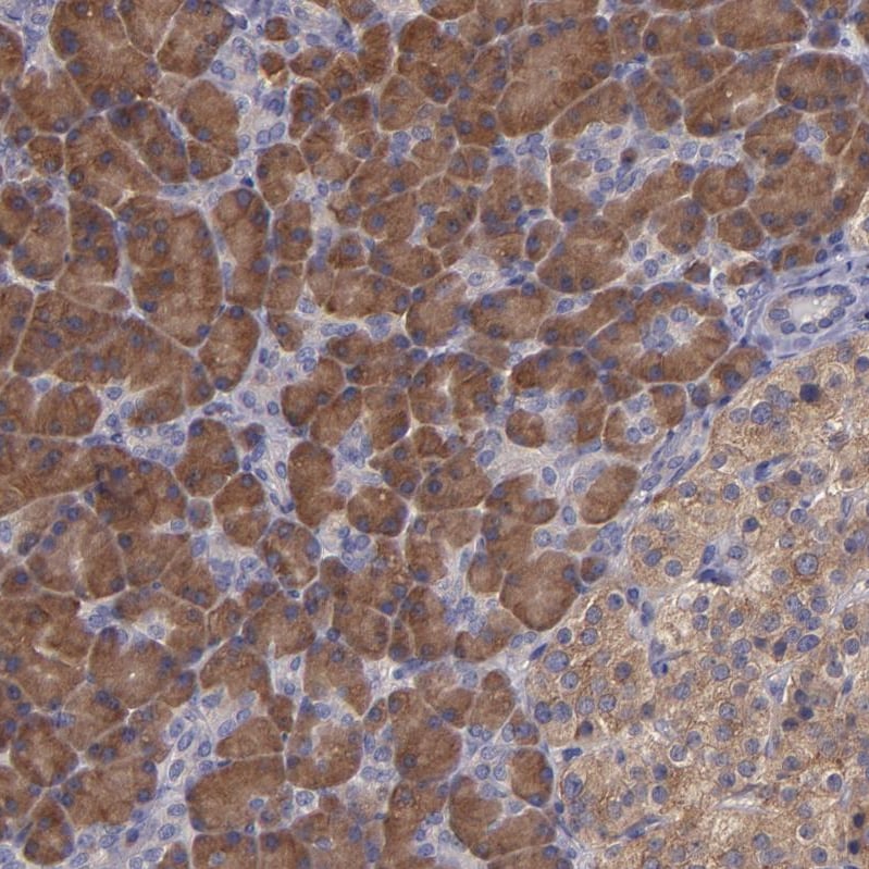 CARS Antibody - BSA Free Immunohistochemistry-Paraffin: CARS Antibody [NBP1-86623]