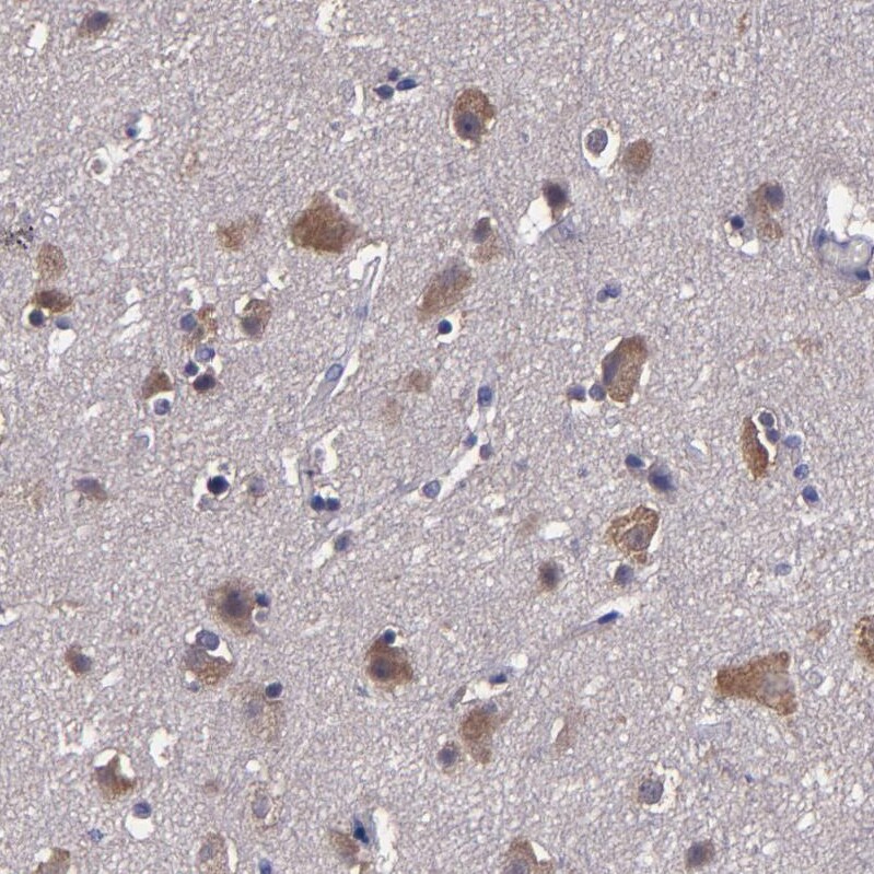 CARS Antibody - BSA Free Immunohistochemistry-Paraffin: CARS Antibody [NBP1-86623]