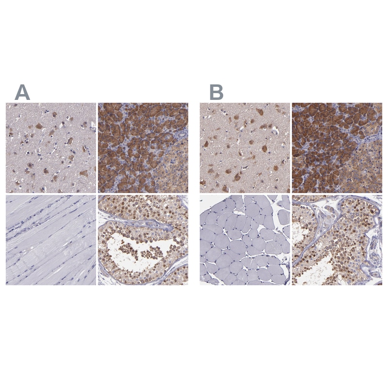 CARS Antibody - BSA Free Immunohistochemistry-Paraffin: CARS Antibody [NBP1-86623]