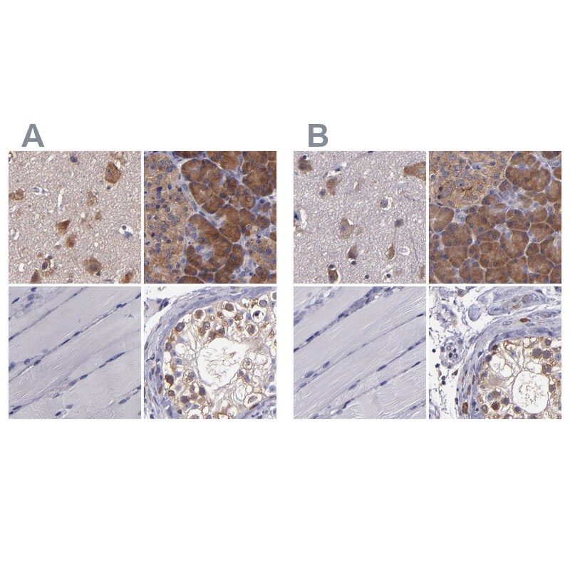 CARS Antibody - BSA Free Immunohistochemistry-Paraffin: CARS Antibody - BSA Free [NBP1-86624]