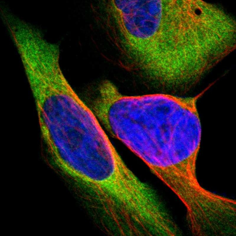 CARS Antibody - BSA Free Immunohistochemistry-Paraffin: CARS Antibody - BSA Free [NBP1-86624]