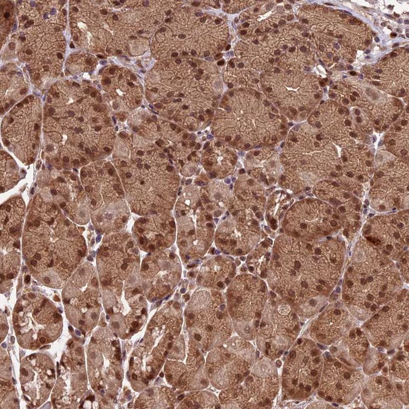 CARF/CDKN2AIP Antibody - BSA Free Immunohistochemistry-Paraffin: CARF/CDKN2AIP Antibody - BSA Free [NBP1-86628]