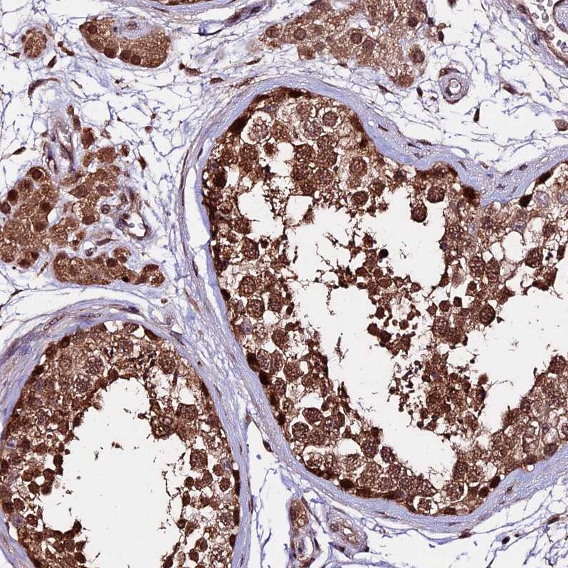 CARF/CDKN2AIP Antibody - BSA Free Immunohistochemistry-Paraffin: CARF/CDKN2AIP Antibody - BSA Free [NBP1-86628]