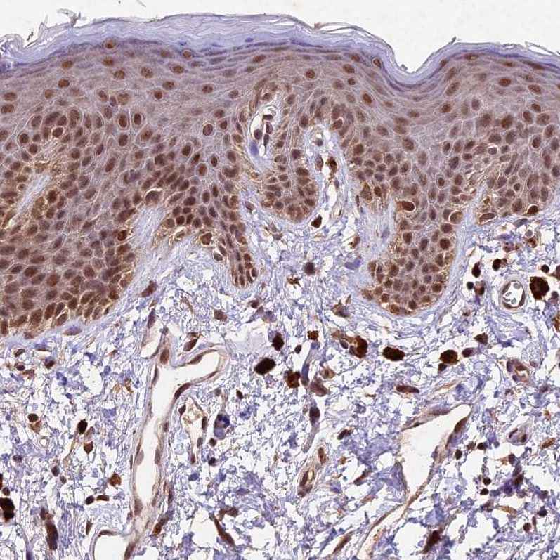 CARF/CDKN2AIP Antibody - BSA Free Immunohistochemistry-Paraffin: CARF/CDKN2AIP Antibody - BSA Free [NBP1-86628]