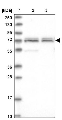 CARF/CDKN2AIP Antibody - BSA Free Western Blot: CARF/CDKN2AIP Antibody - BSA Free [NBP1-86628]