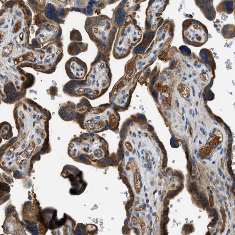 RIPK2 Antibody - BSA Free Immunohistochemistry-Paraffin: RIPK2 Antibody [NBP1-86629]