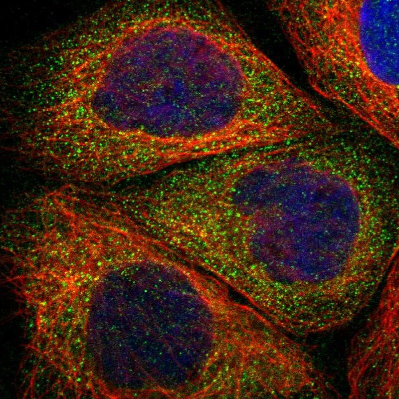RIPK2 Antibody - BSA Free Immunocytochemistry/ Immunofluorescence: RIPK2 Antibody [NBP1-86630]