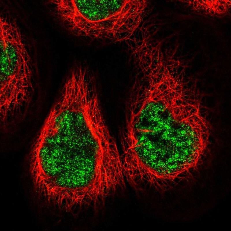NCAPG2 Antibody - BSA Free Immunohistochemistry-Paraffin: NCAPG2 Antibody - BSA Free [NBP1-86633]