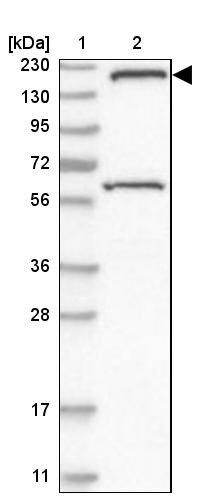 SMC4 Antibody - BSA Free Western Blot: SMC4 Antibody - BSA Free [NBP1-86635]