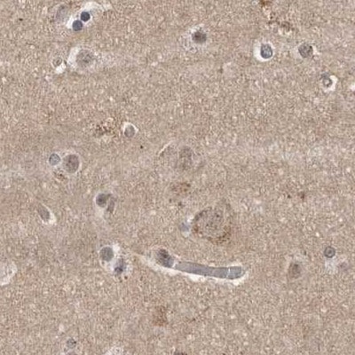 CEP350 Antibody - BSA Free Immunohistochemistry: CEP350 Antibody - BSA Free [NBP1-86637]
