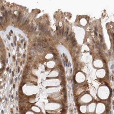 CEP350 Antibody - BSA Free Immunohistochemistry: CEP350 Antibody - BSA Free [NBP1-86637]