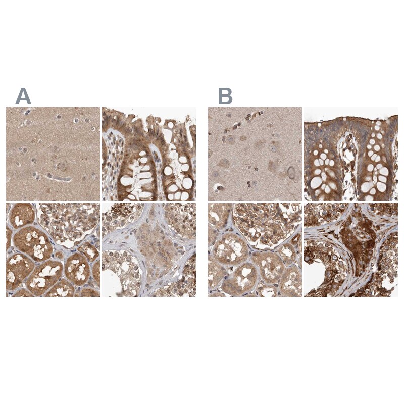 CEP350 Antibody - BSA Free Immunohistochemistry: CEP350 Antibody - BSA Free [NBP1-86637]