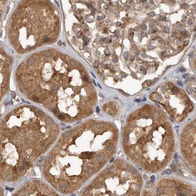 CEP350 Antibody - BSA Free Immunohistochemistry: CEP350 Antibody - BSA Free [NBP1-86637]