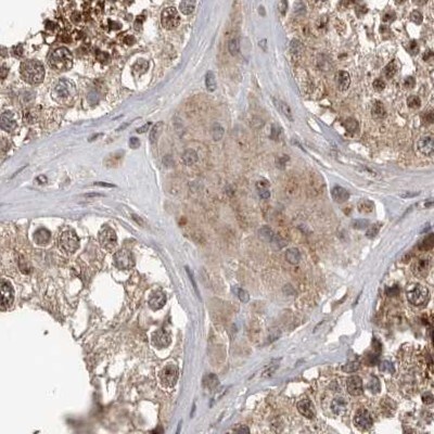 CEP350 Antibody - BSA Free Immunohistochemistry: CEP350 Antibody - BSA Free [NBP1-86637]