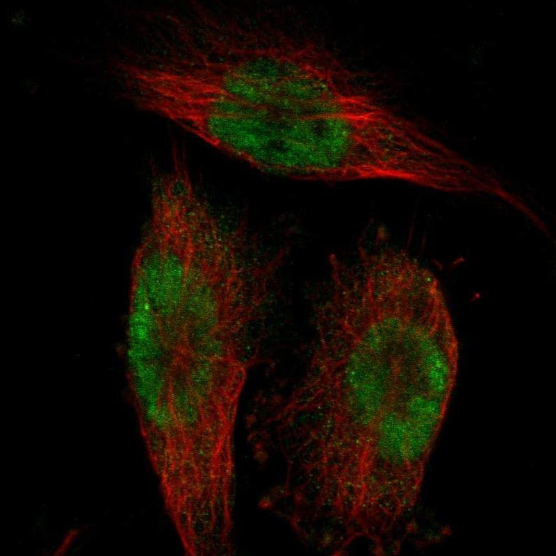 BRD4 Antibody - BSA Free Immunohistochemistry-Paraffin: BRD4 Antibody - BSA Free [NBP1-86640]