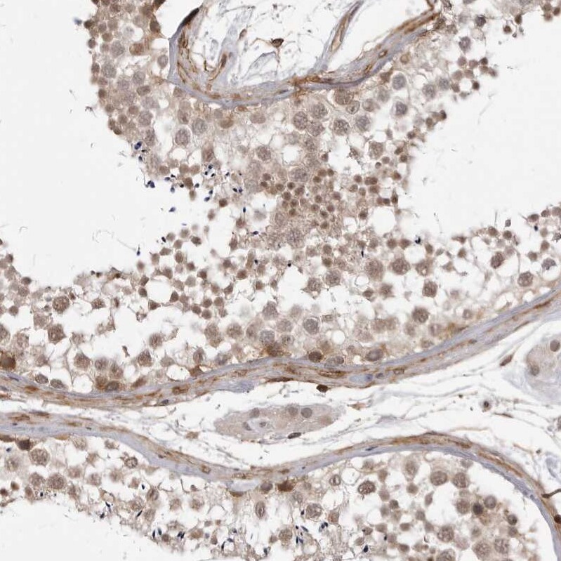 SORBS1 Antibody - BSA Free Immunohistochemistry-Paraffin: SORBS1 Antibody - BSA Free [NBP1-86641]