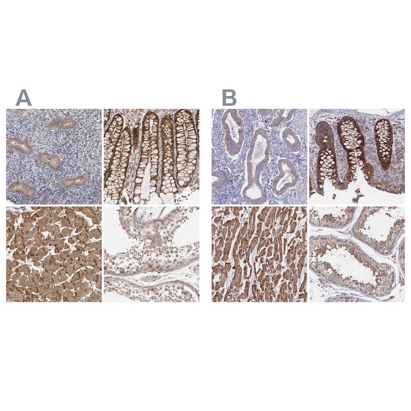 SORBS1 Antibody - BSA Free Immunohistochemistry-Paraffin: SORBS1 Antibody - BSA Free [NBP1-86641]