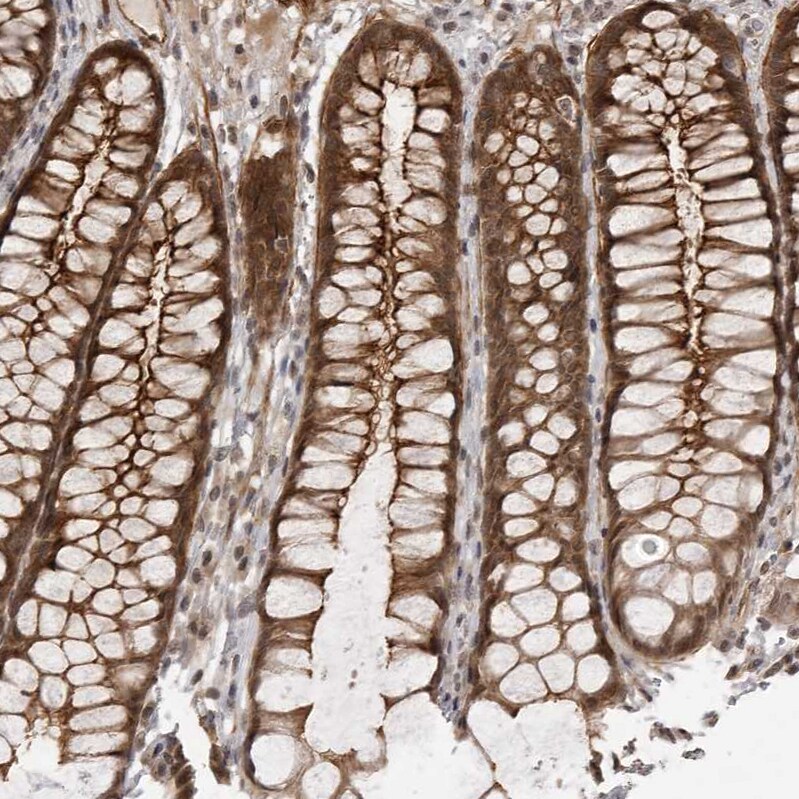 SORBS1 Antibody - BSA Free Immunohistochemistry-Paraffin: SORBS1 Antibody - BSA Free [NBP1-86641]