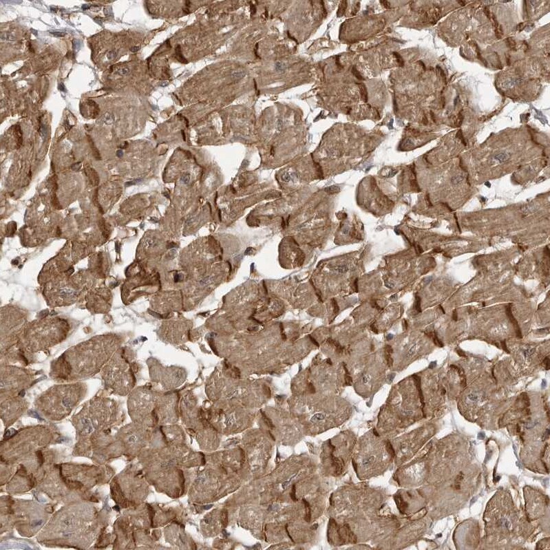 SORBS1 Antibody - BSA Free Immunohistochemistry-Paraffin: SORBS1 Antibody - BSA Free [NBP1-86641]