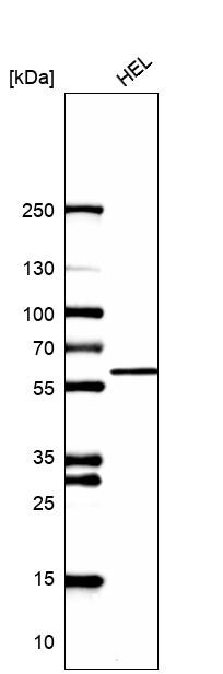 CAP1 Antibody - BSA Free Western Blot: CAP1 Antibody - BSA Free [NBP1-86644]