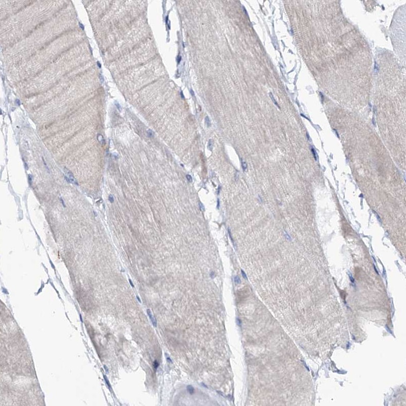 FAM111B Antibody - BSA Free Immunohistochemistry-Paraffin: FAM111B Antibody [NBP1-86645]