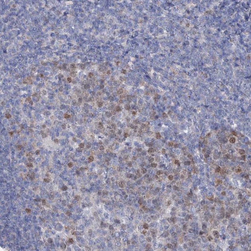 FAM111B Antibody - BSA Free Immunohistochemistry-Paraffin: FAM111B Antibody [NBP1-86645]