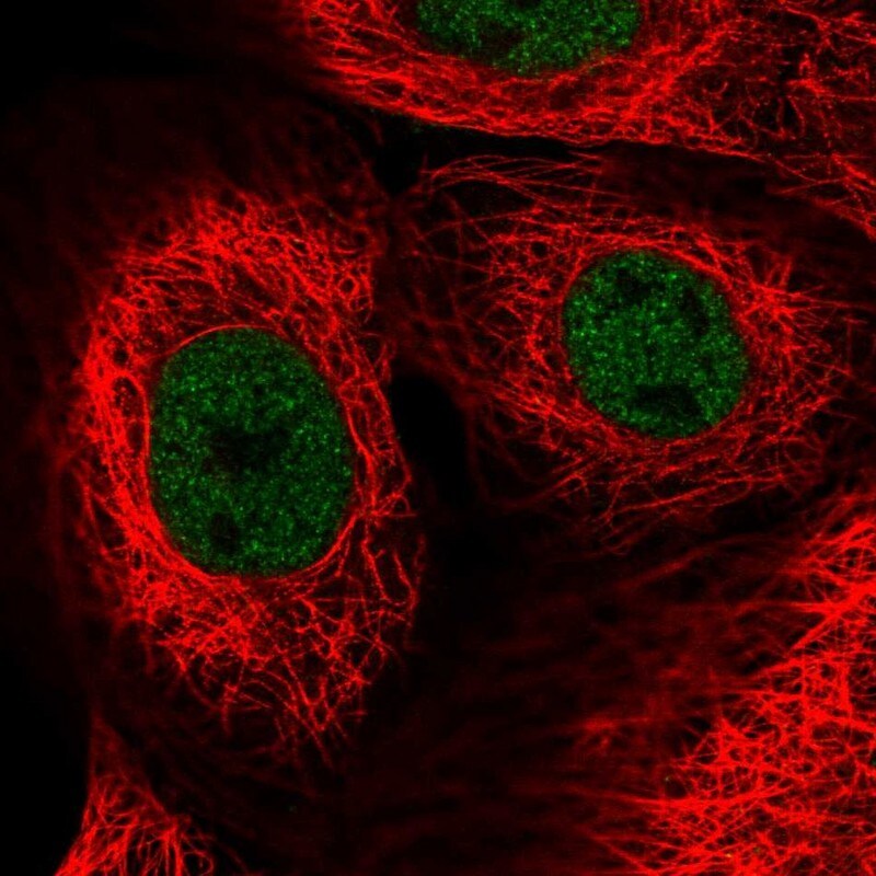 ZNF592 Antibody - BSA Free Immunohistochemistry-Paraffin: ZNF592 Antibody - BSA Free [NBP1-86647]