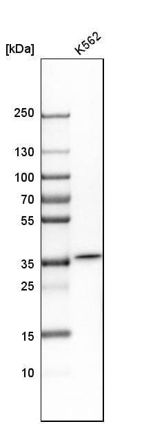 Carbonic Anhydrase VIII/CA8 Antibody - BSA Free Western Blot: Carbonic Anhydrase VIII/CA8 Antibody - BSA Free [NBP1-86654]