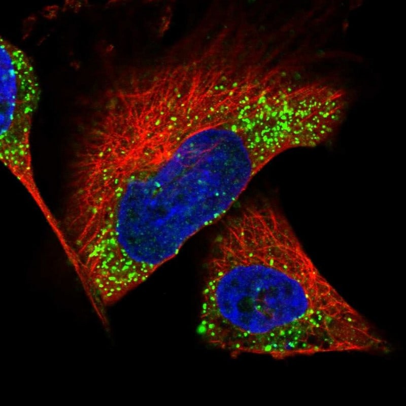 Calbindin D-28K Antibody - BSA Free Immunocytochemistry/ Immunofluorescence: Calbindin D-28K Antibody [NBP1-86664]