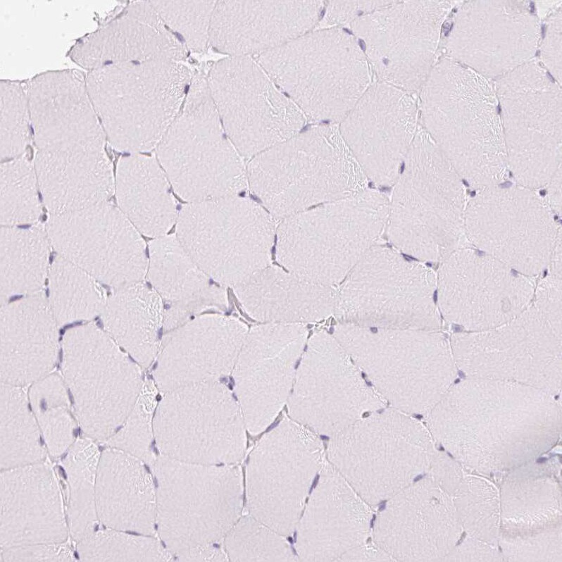Calbindin D-28K Antibody - BSA Free Immunohistochemistry-Paraffin: Calbindin D-28K Antibody - BSA Free [NBP1-86664]