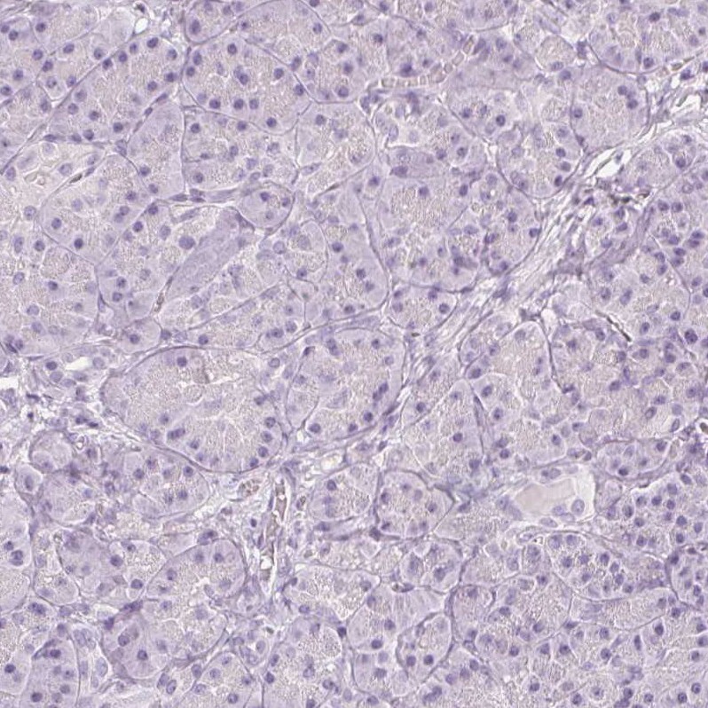 Calbindin D-28K Antibody - BSA Free Immunohistochemistry-Paraffin: Calbindin D-28K Antibody - BSA Free [NBP1-86664]