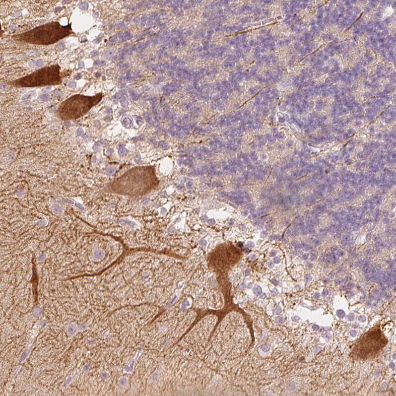 Calbindin D-28K Antibody - BSA Free Immunohistochemistry-Paraffin: Calbindin D-28K Antibody - BSA Free [NBP1-86664]