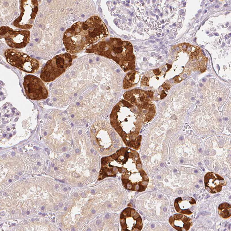 Calbindin D-28K Antibody - BSA Free Immunohistochemistry-Paraffin: Calbindin D-28K Antibody - BSA Free [NBP1-86664]