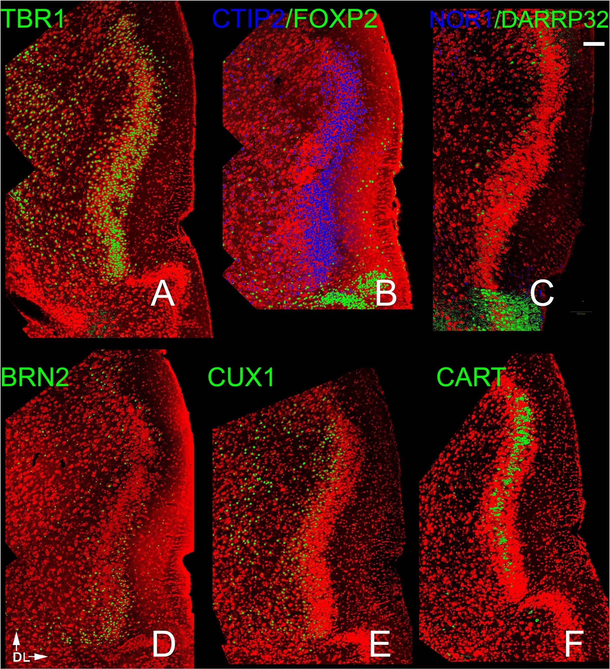FoxP2 Antibody
