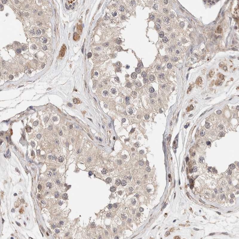 CASK Antibody - BSA Free Immunohistochemistry-Paraffin: CASK Antibody [NBP1-86673]