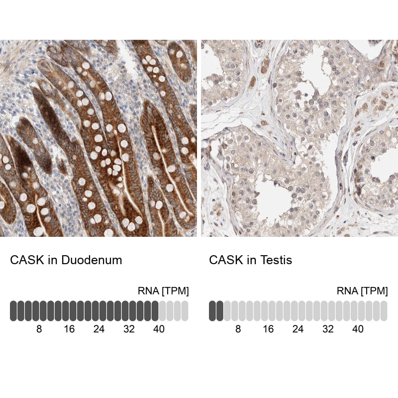 CASK Antibody - BSA Free Immunohistochemistry-Paraffin: CASK Antibody [NBP1-86673]