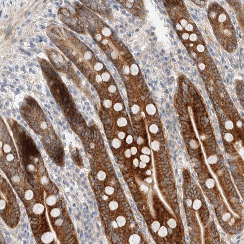 CASK Antibody - BSA Free Immunohistochemistry-Paraffin: CASK Antibody [NBP1-86673]