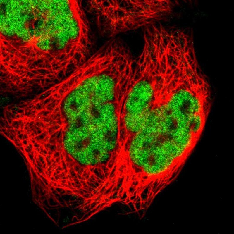 ZNF384 Antibody - BSA Free Immunocytochemistry/ Immunofluorescence: ZNF384 Antibody [NBP1-86675]