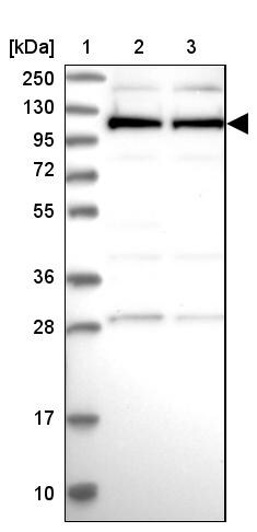 Cactin Antibody - BSA Free Western Blot: Cactin Antibody - BSA Free [NBP1-86678]