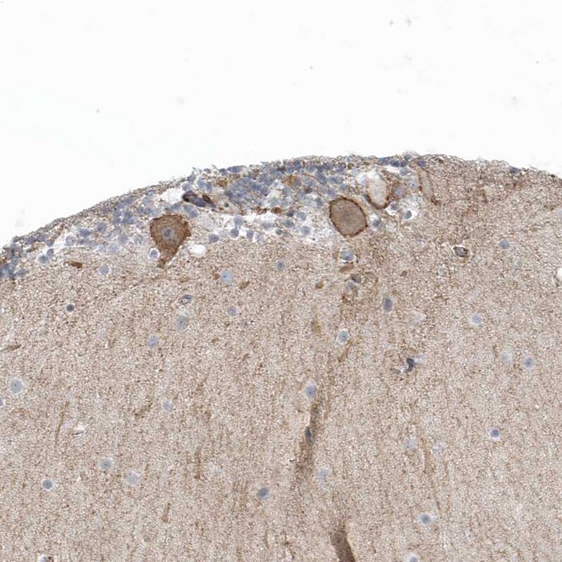 CACNB2 Antibody - BSA Free Immunohistochemistry-Paraffin: CACNB2 Antibody [NBP1-86680]