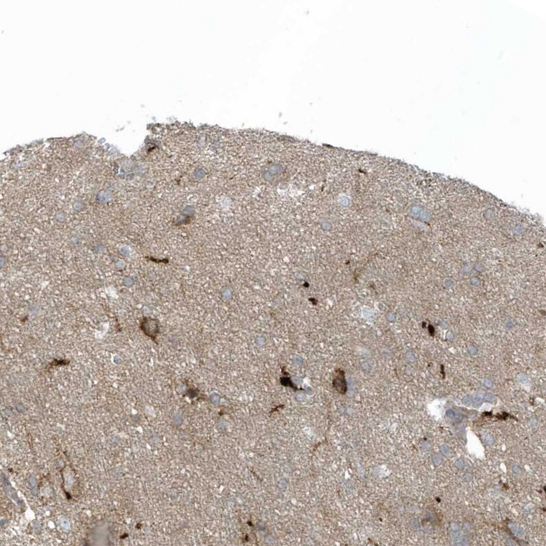 CACNB2 Antibody - BSA Free Immunohistochemistry-Paraffin: CACNB2 Antibody [NBP1-86680]