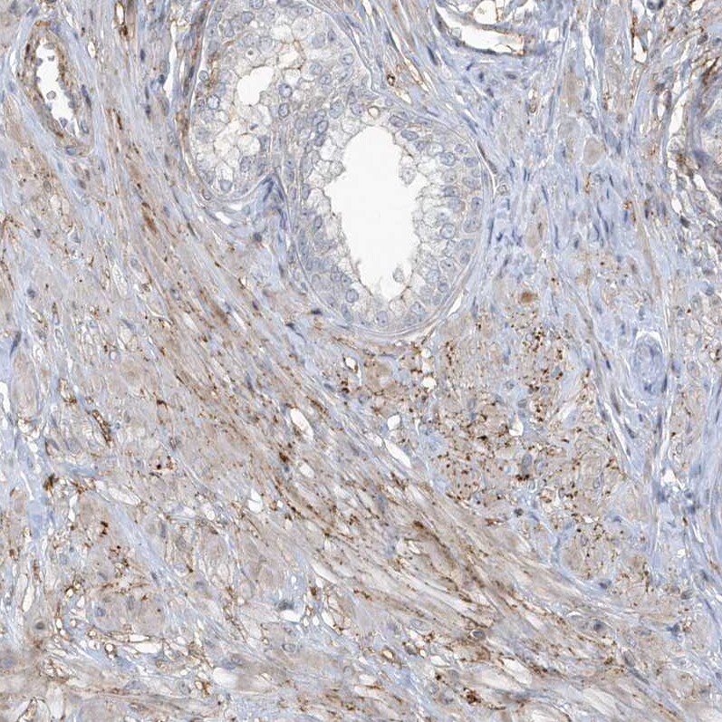 CACNB2 Antibody - BSA Free Immunohistochemistry-Paraffin: CACNB2 Antibody [NBP1-86680]